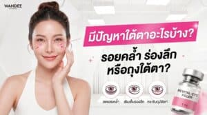 เปรียบเทียบปัญหาใต้ตา รอยคล้ำ ร่องลึกใต้ตา และถุงใต้ตา พร้อมอธิบายความแตกต่างและแนวทางรักษาให้เหมาะกับแต่ละปัญหา โดย Wandee Clinic