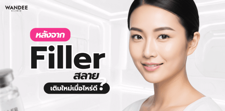 หลังสลายฟิลเลอร์ อยากเติมฟิลเลอร์ใหม่ควรประเมินสภาพผิว โครงหน้า และตำแหน่งฉีดก่อนฉีดซ้ำ เพื่อให้ได้ผลลัพธ์ที่ปลอดภัยและเป็นธรรมชาติ