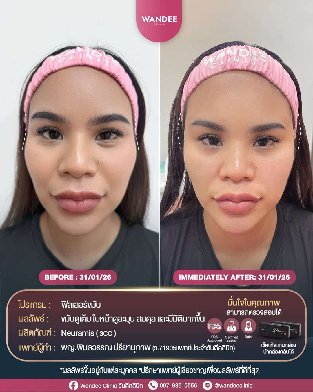 ขมับตอบ หน้าดูแข็ง อย่าปล่อยไว้