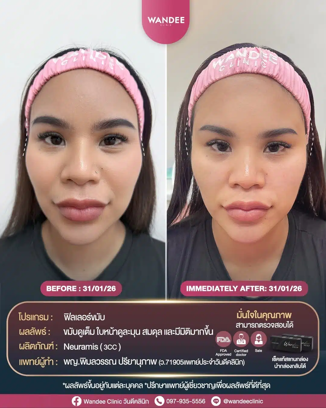 ขมับตอบ หน้าดูแข็ง อย่าปล่อยไว้