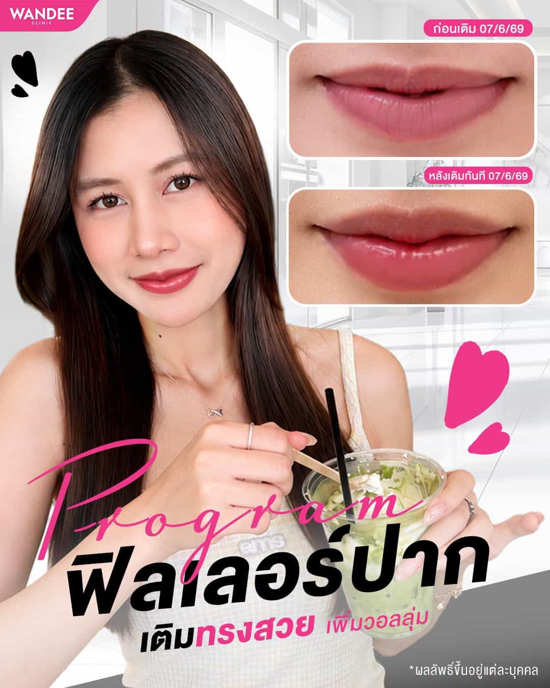 ปากสวยเป็นทรง อิ่มฟู ดูมีวอลลุ่ม