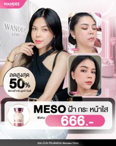 ฝ้า กระ จุดด่างดำ