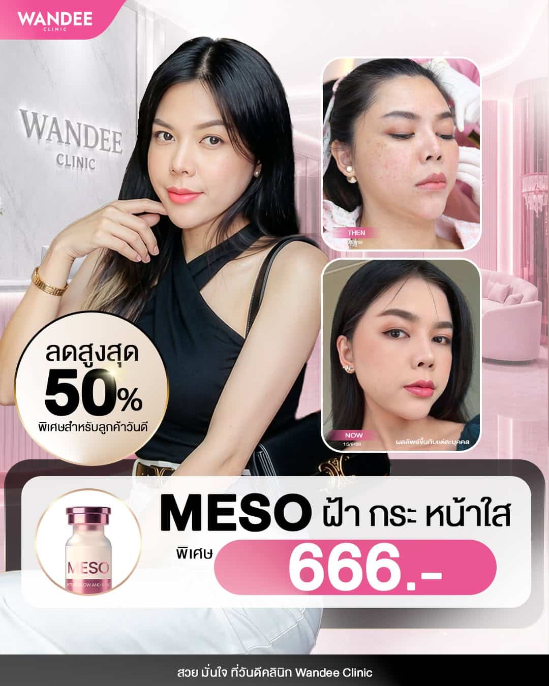 ฝ้า กระ จุดด่างดำ