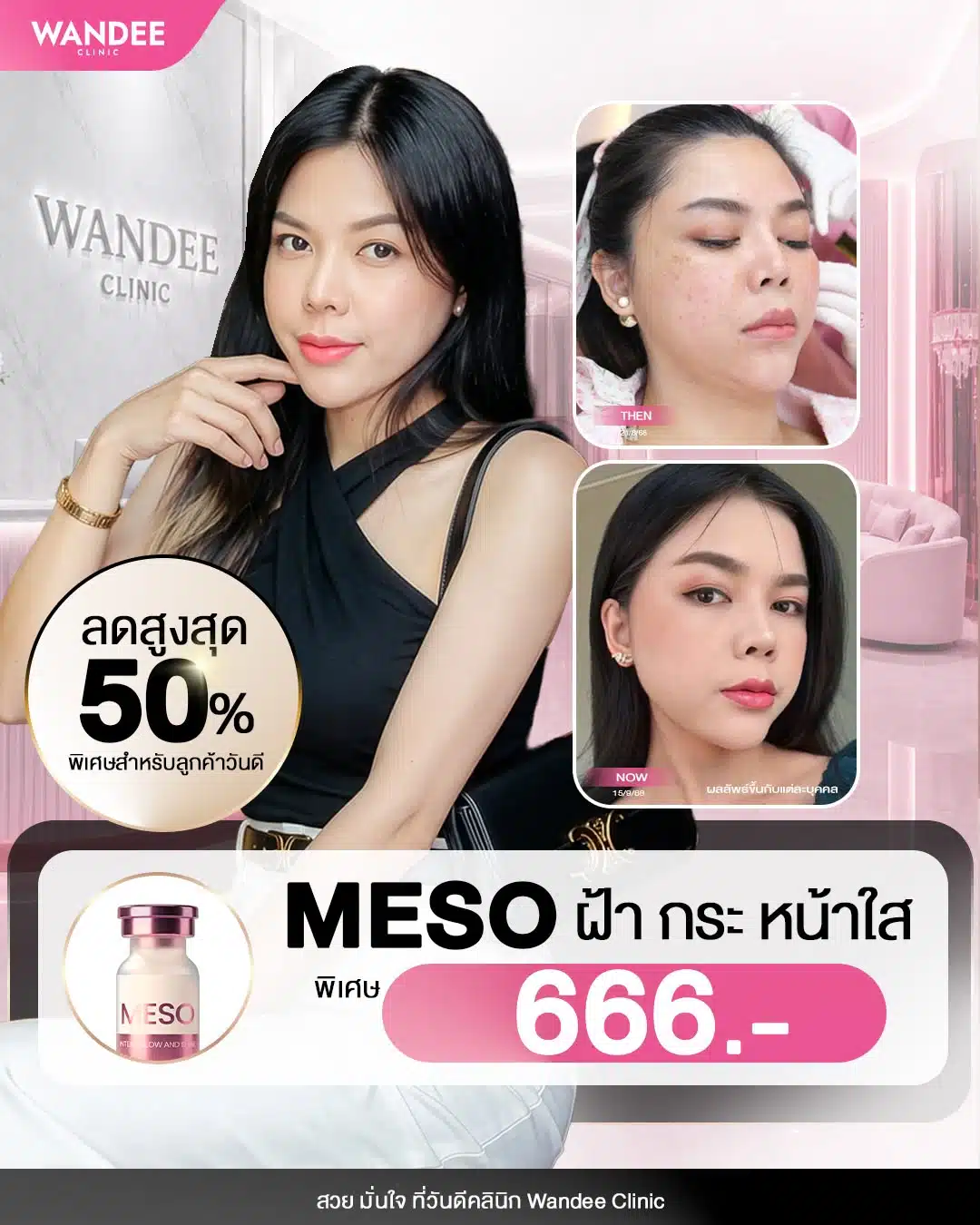 ฝ้า กระ จุดด่างดำ