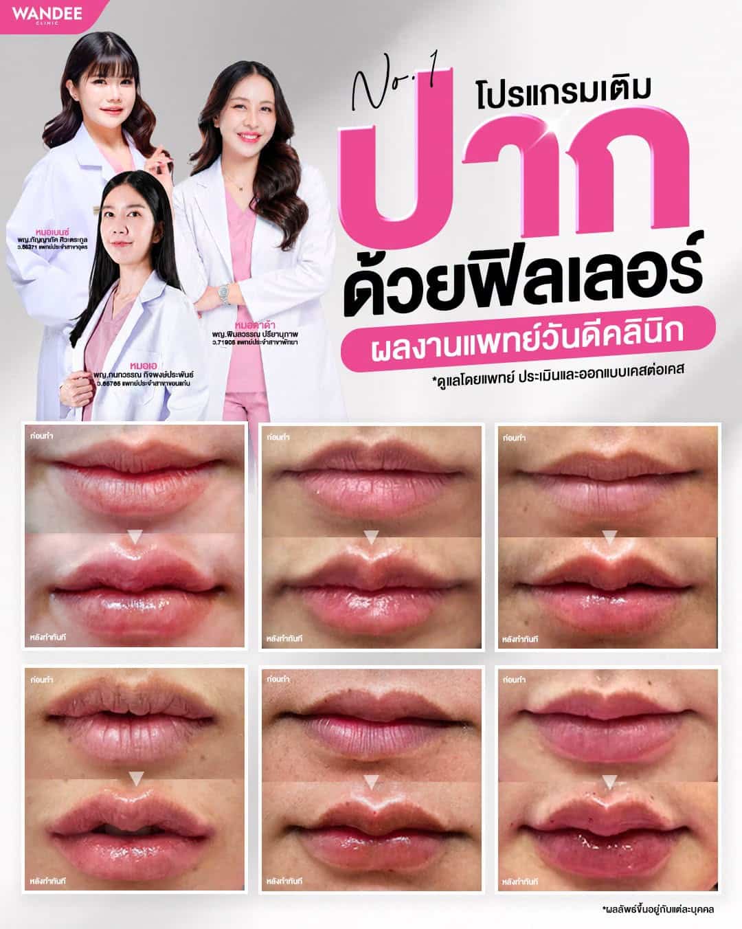 รวมผลงานเติมปากสวย