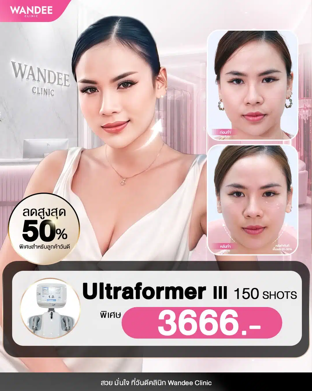 หน้าเริ่มหย่อน