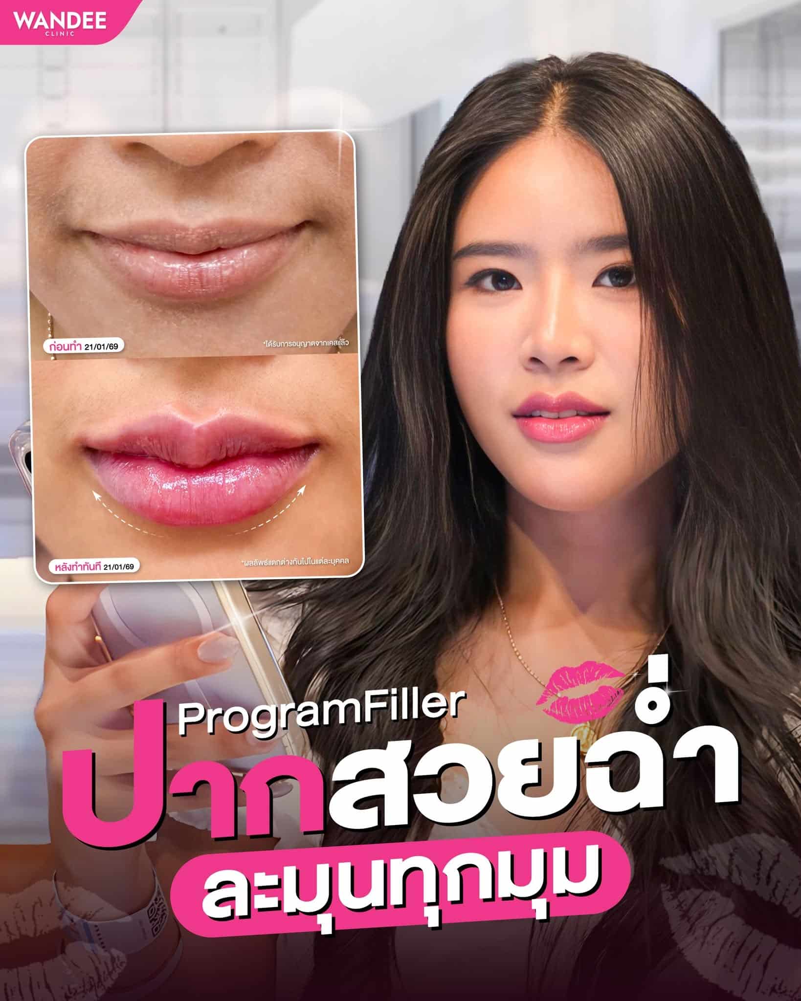 เติมปากสวย ปรับลุคละมุนทั้งหน้า