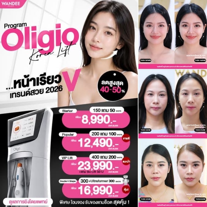 𝗣𝗿𝗼𝗴𝗿𝗮𝗺 𝗢𝗹𝗶𝗴𝗶𝗼 ลดสูงสุด 𝟱𝟬