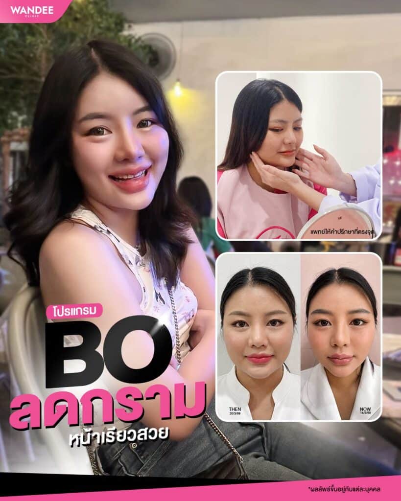 กรามใหญ่ ไม่มั่นใจ ขอเป็นหน้าเรียวสวยได้มั้ยคะ!🥺 จัดนี่เลย 𝗣𝗿𝗼𝗴𝗿𝗮𝗺 𝗕𝗼