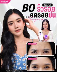 ขมวดคิ้วทีรอยย่นโผล่