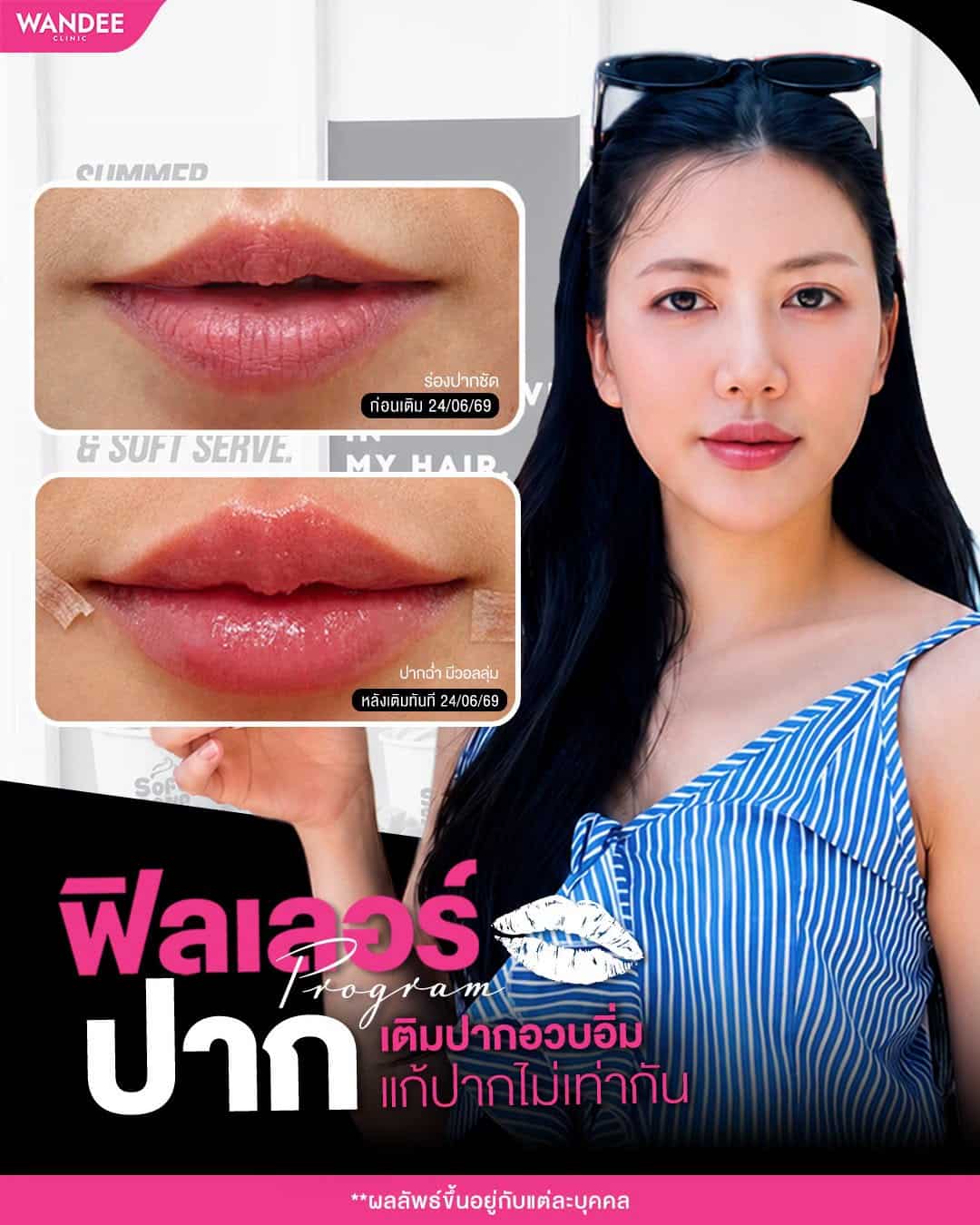 ปากฉ่ำวอลลุ่ม