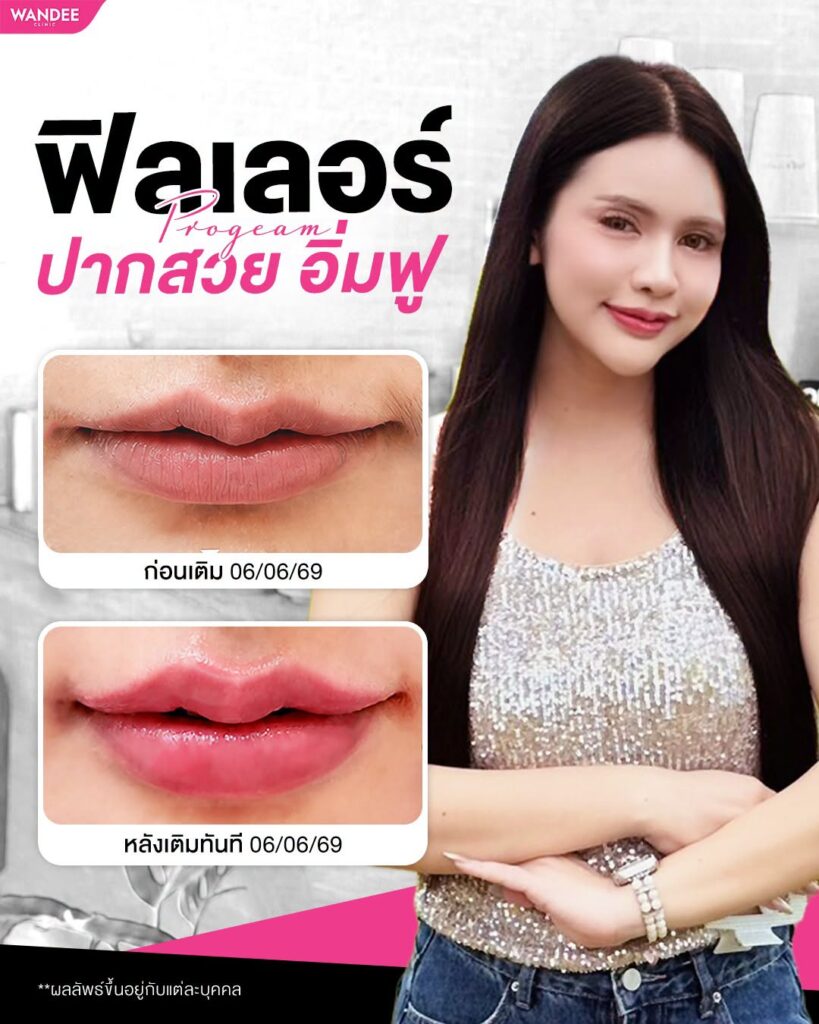 เรฟนี้ต้องเซฟแล้วนะ