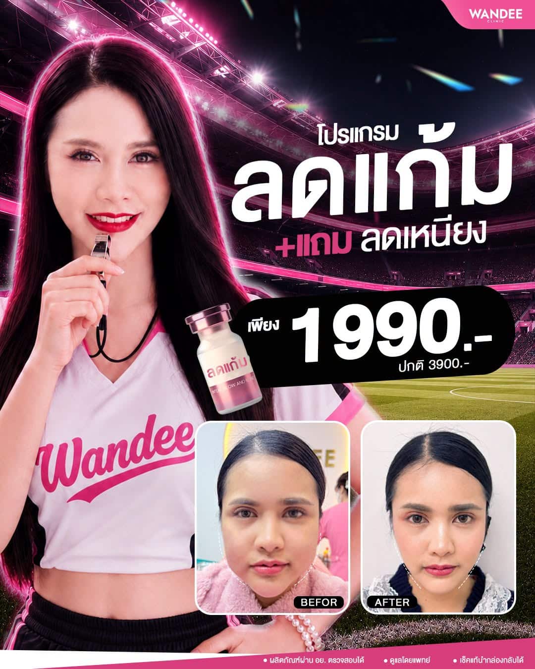 แมตช์นี้แก้มเหนียง